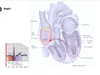 ECG